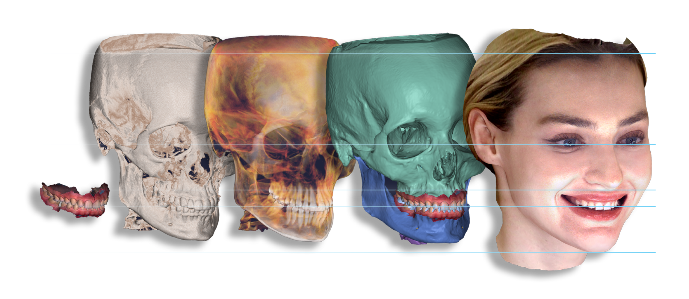 RAYFace_Segmentation_Graphic