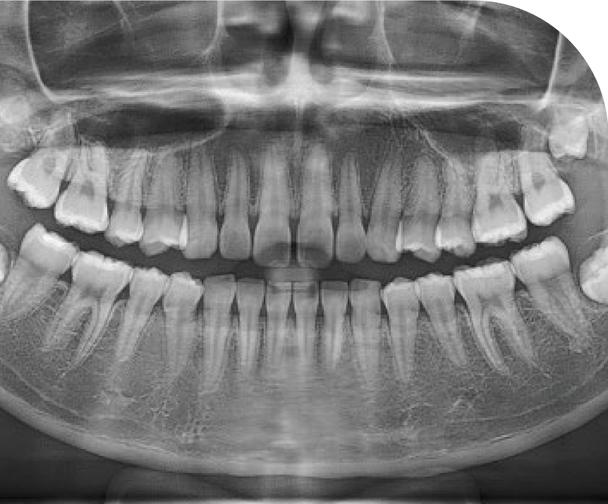 Clear Panorama - Comprehensive Dental Imaging